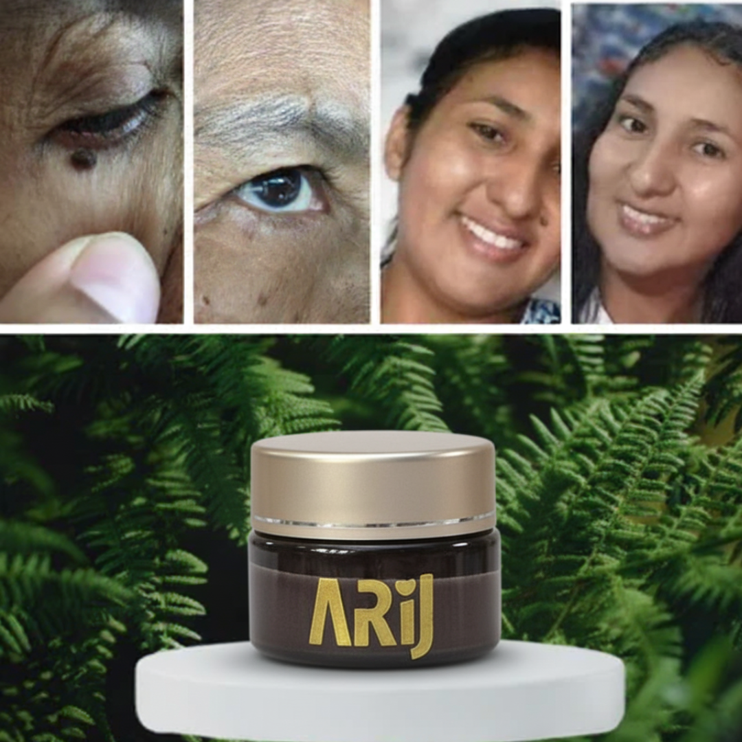 crema elimina verrugas lunares y mezquinos